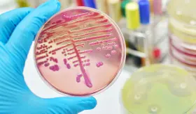 As&iacute; es la Klebsiella, una superbacteria que resiste a los antibi&oacute;ticos y se contagia en los hospitales