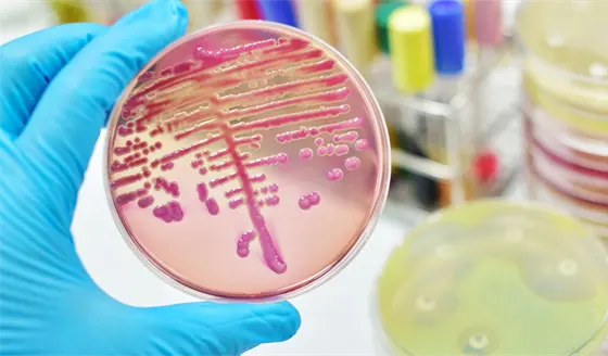 As&iacute; es la Klebsiella, una superbacteria que resiste a los antibi&oacute;ticos y se contagia en los hospitales