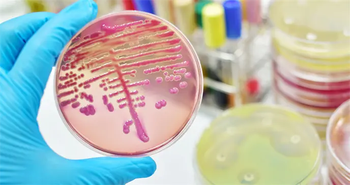 As&iacute; es la Klebsiella, una superbacteria que resiste a los antibi&oacute;ticos y se contagia en los hospitales