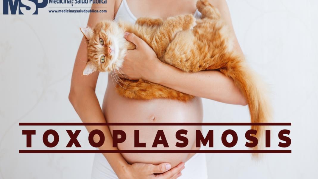 Toxoplasmosis