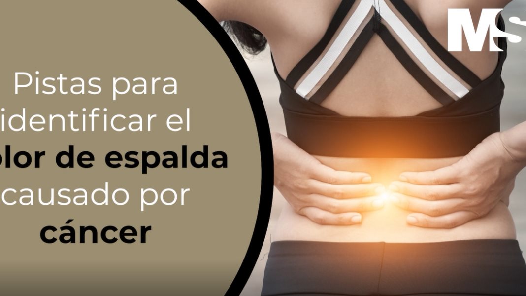 Pistas para identificar el dolor de espalda causado por cáncer