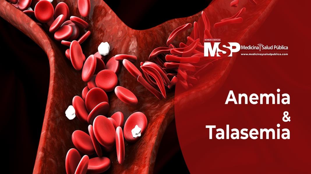 Anemia Falciforme - Dr. Alberto Santiago Cornier