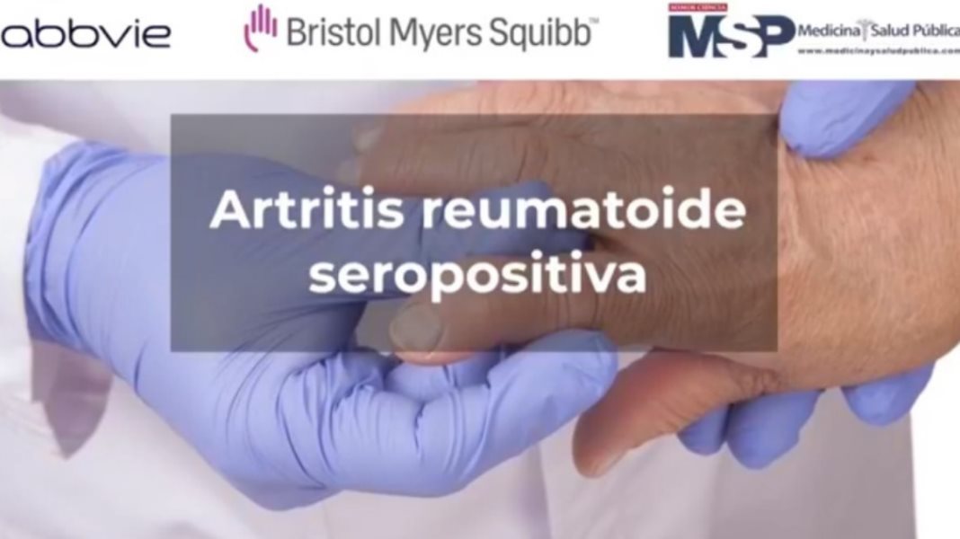 Cuidamos tu Salud: Artritis reumatoide seropositiva
