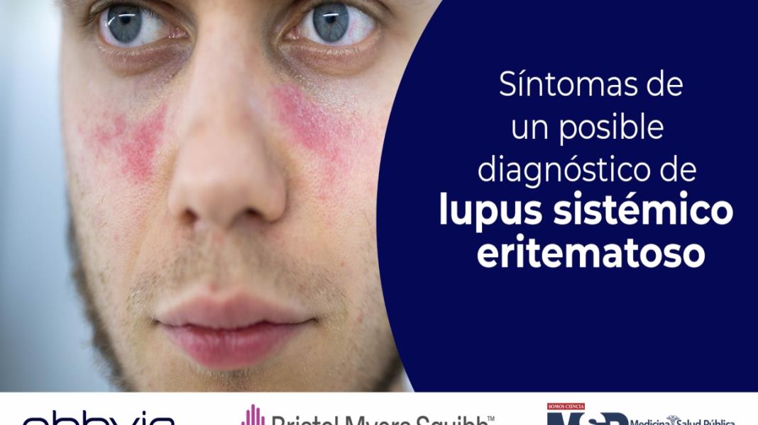 Síntomas de un posible diagnóstico de lupus sistémico eritematoso