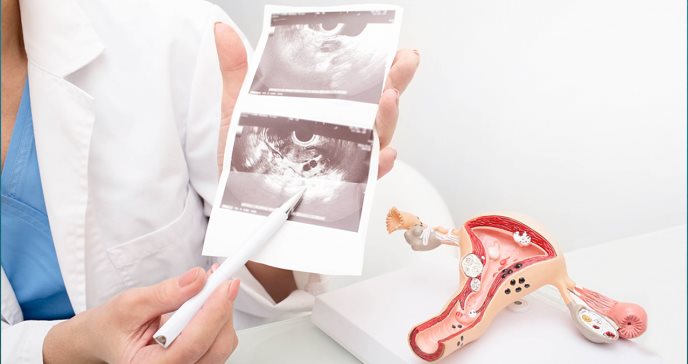 Cómo pueden afectar los desequilibrios hormonales al útero