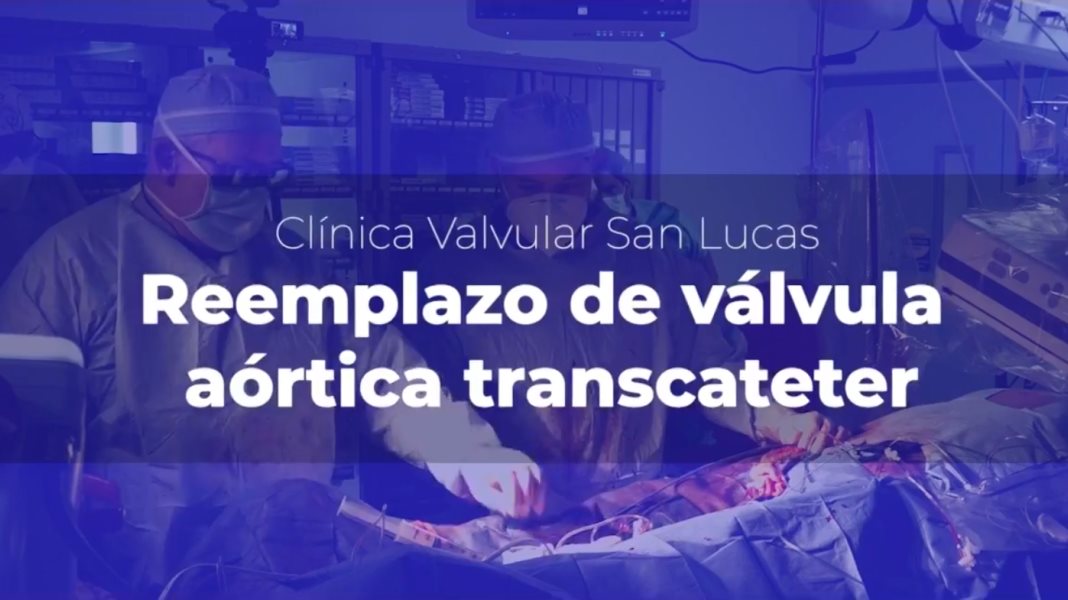 Reemplazo de válvula aórtica transcatéter - Centro Médico Episcopal San Lucas