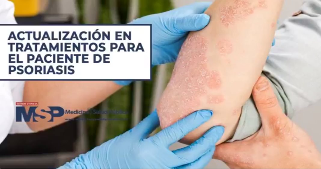Actualización en tratamientos para el paciente de psoriasis