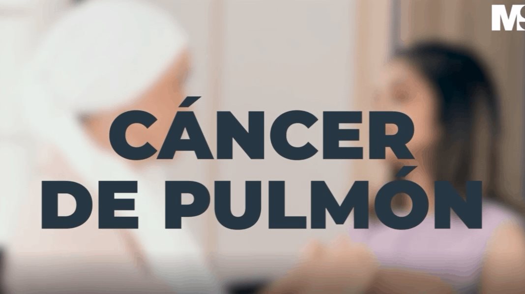 Cáncer de Pulmón - Dr. Nelson Matos