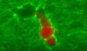 Linfocitos T citotóxicos abren túneles y llegan a las células tumorales para eliminarlas