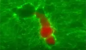 Linfocitos T citot&oacute;xicos abren t&uacute;neles y llegan a las c&eacute;lulas tumorales para eliminarlas