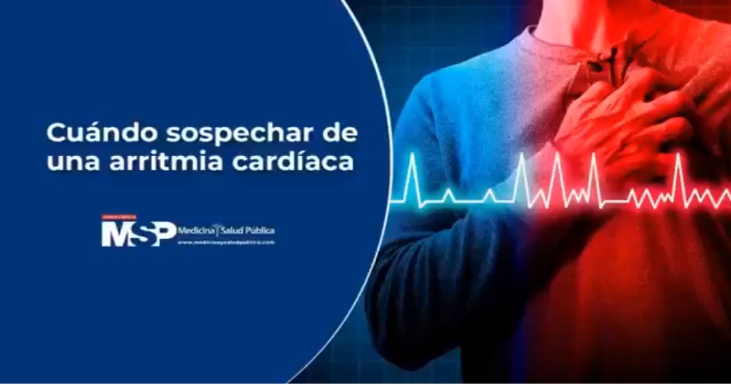 Cuándo sospechar de una arritmia cardíaca