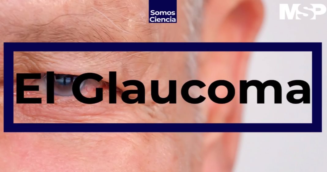 Cápsula Educativa - El Glaucoma