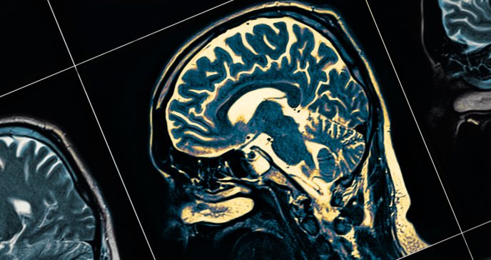 La epilepsia se vincula con riesgo de eventos adversos cardiovasculares mayores