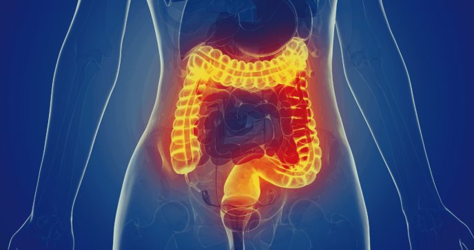 La mala absorción de carbohidratos elevaría el riesgo de síndrome de intestino irritable