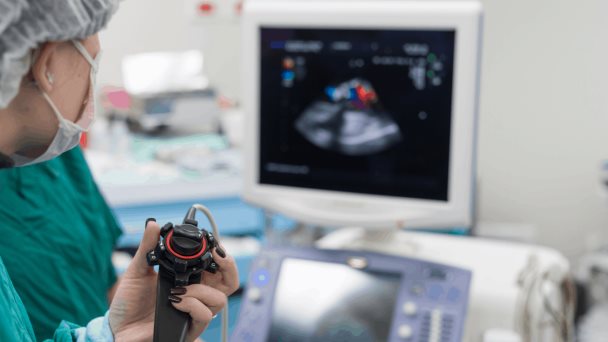 El perfil de riesgo de enfermedad cardiovascular en pacientes con diabetes está cambiando El perfil de riesgo de enfermedad cardiovascular en pacientes con diabetes está cambiando