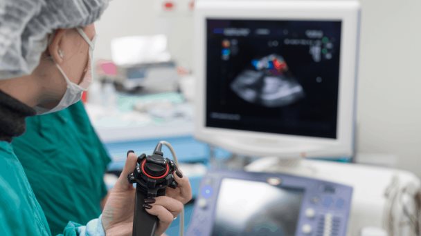 La ecocardiografía predice mejor el riesgo cardiovascular en pacientes con diabetes