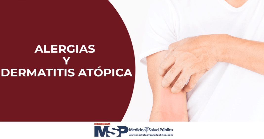 Alergias y Dermatitis Atópica - Dr. Daniel Amaya
