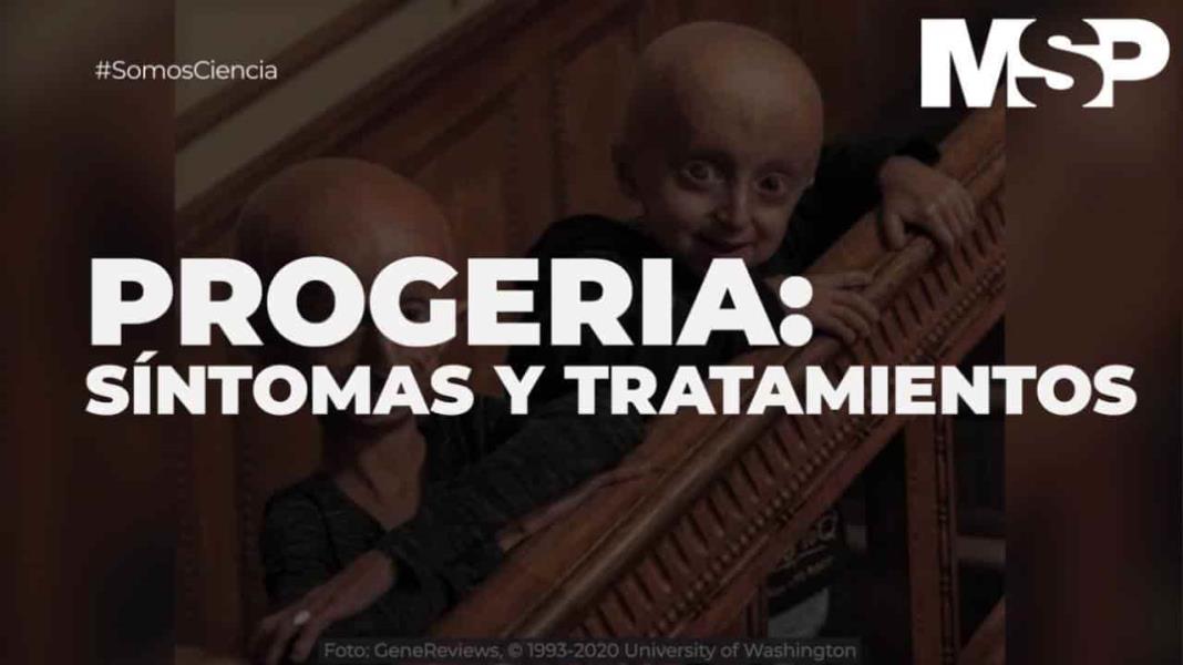 Progeria: Síntomas y tratamientos