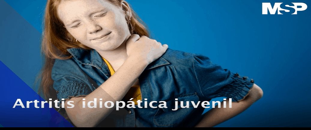 Artritis idiopática juvenil - Cápsula educativa
