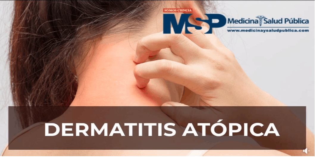 Dermatitis Atópica
