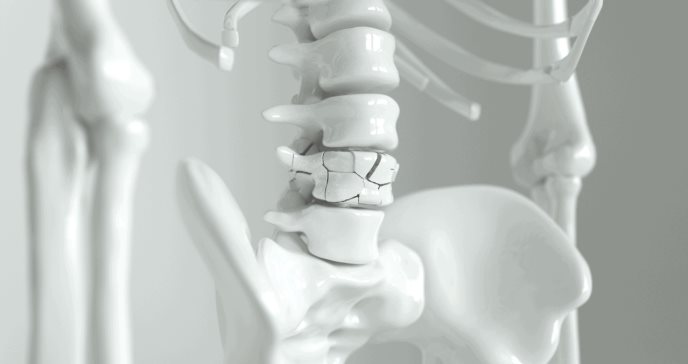 Los suplementos de calcio y vitamina D no evitan fracturas de huesos