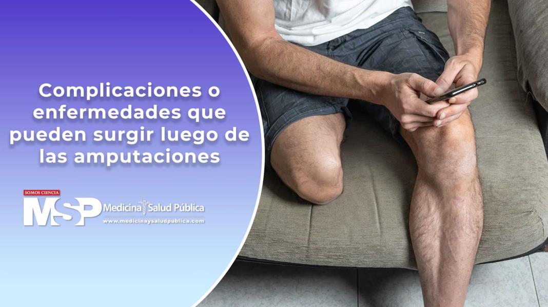 Complicaciones o enfermedades que pueden surgir luego de las amputaciones