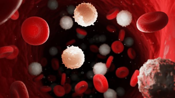 Pruebas genéticas: el futuro terapéutico de la leucemia linfoblástica aguda Pruebas genéticas: el futuro terapéutico de la leucemia linfoblástica aguda