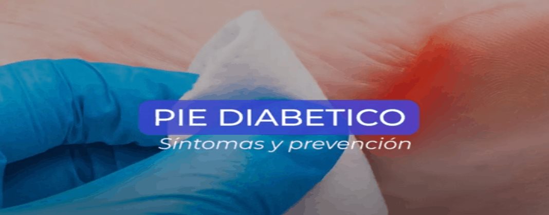 Pie diabético síntomas y prevención