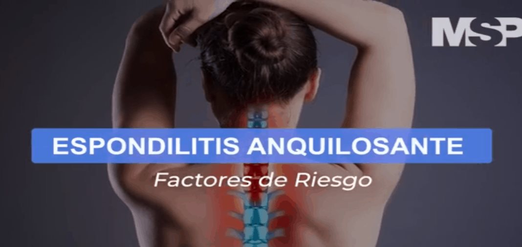 Espondilitis anquilosante - Cápsula Educativa