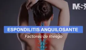 Espondilitis anquilosante - Cápsula Educativa