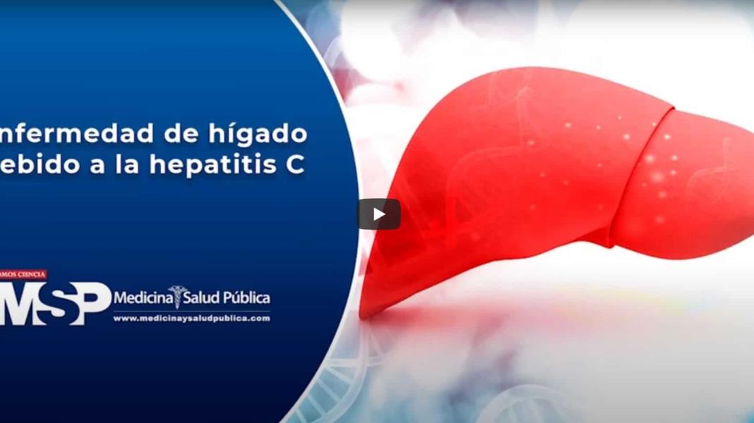 Enfermedad de Hígado debido a Hepatitis C