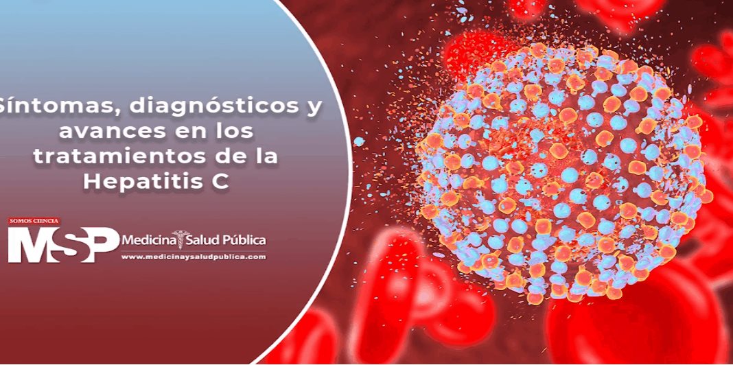 Síntomas, diagnóstico y avances en los tratamientos de la Hepatitis C