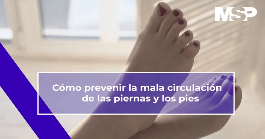 Cómo prevenir la mala circulación de las piernas y los pies