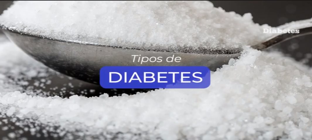 Tipos de Diabetes - Cápsula informativa