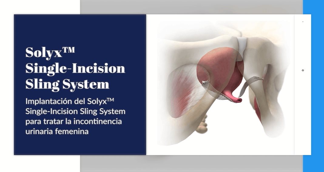 Solyx TM: nuevo mecanismo para evitar la incontinencia femenina