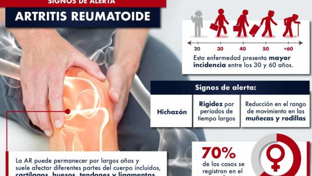 Artritis Reumatoide: signos de alerta