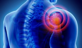 Evalúan nuevas opciones terapéuticas para evitar la sarcopenia en pacientes reumáticos