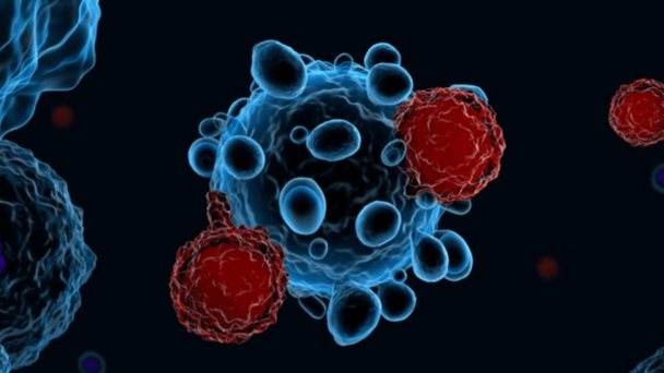 Estudio sugiere que la terapia celular con linfocitos revertiría cáncer de pulmón de células no pequeñas Estudio sugiere que la terapia celular con linfocitos revertiría cáncer de pulmón de células no pequeñas