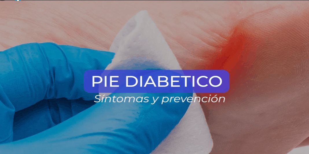 Pie diabético: síntomas y prevención