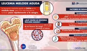 Leucemia Mieloide Aguda