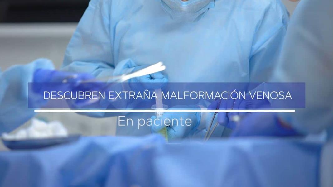 #ExclusivoMSP - Descubren extraña malformación venosa en paciente