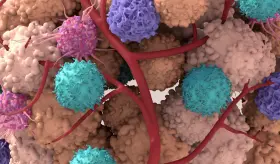 Tratamiento a base de  pembrolizumab en pacientes con melanoma plantea interrogantes