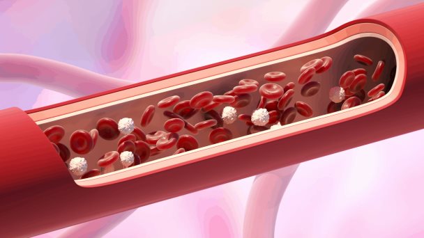 Mejorar la salud de los vasos sanguíneos en el cerebro ayudaría a combatir el alzhéimer Mejorar la salud de los vasos sanguíneos en el cerebro ayudaría a combatir el alzhéimer