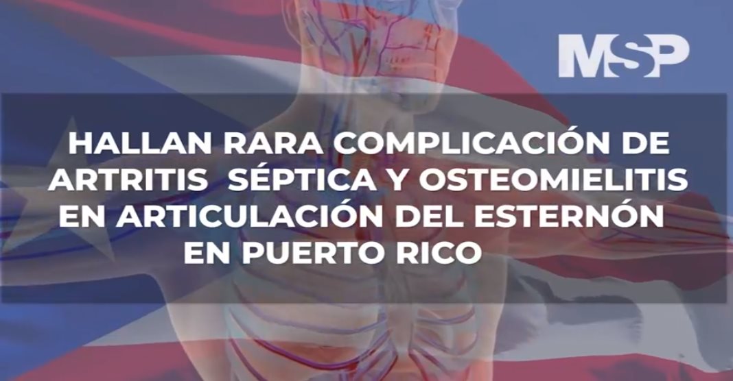 #ExclusivoMSP - Hallan rara complicación de artritis y osteomielitis en esternón de paciente