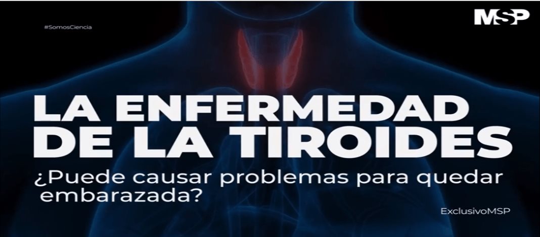 #ExclusivoMSP - La enfermedad de la tiroides en el embarazo
