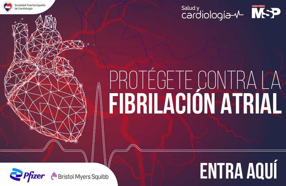 Fibrilación Atrial
