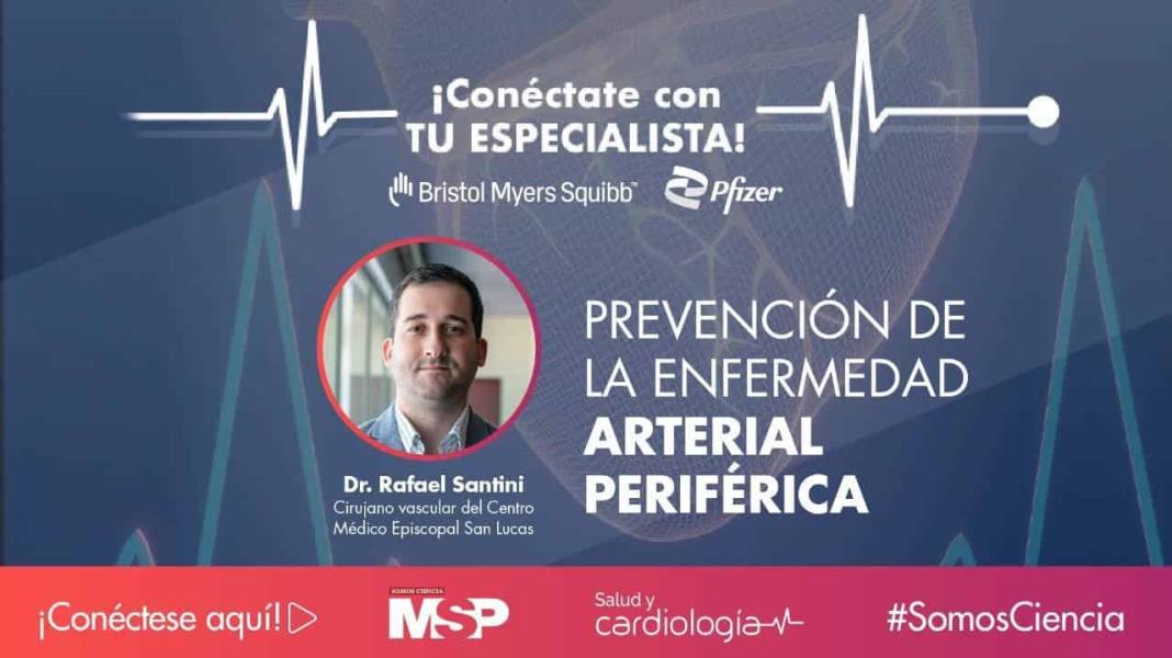 Conéctate: Prevención y tratamiento de peripheral Artery disease