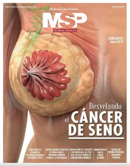 Desvelando el Cáncer de Seno