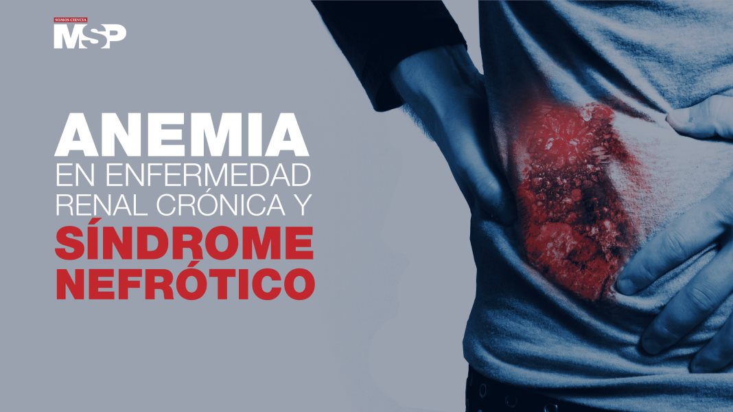 #ExclusivoMSP - Anemia en enfermedad renal crónica y síndrome Nefrótico