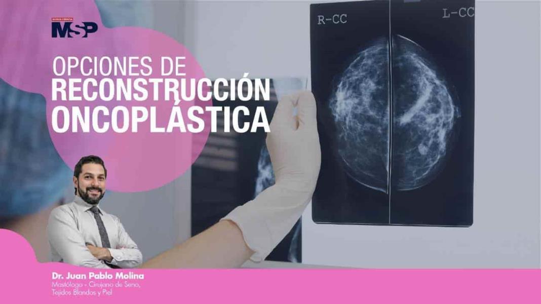#ExclusivoMSP - Opciones de reconstrucción oncoplástica